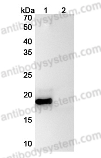 [Antibodysystem] Anti-Human IL11 Antibody (SAA0379)