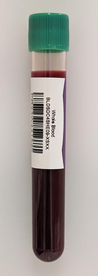 [Research Donors] Fresh whole human blood in sodium heparin - female donor - chilled overnight delivery