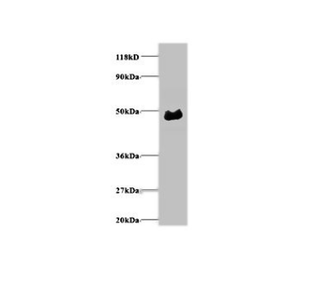 [AFG Scientific] a1-acidglycoprotein Antibody