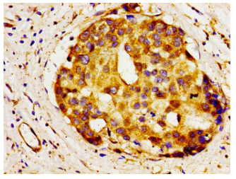 [AFG Scientific] A1BG Antibody