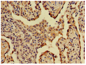 [AFG Scientific] A2ML1 Antibody