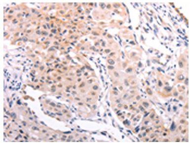 [AFG Scientific] A4GNT Antibody