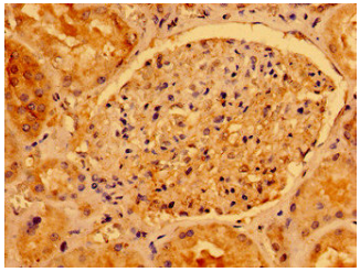 [AFG Scientific] AACS Antibody