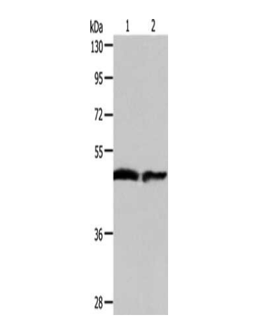 [AFG Scientific] AADAC Antibody