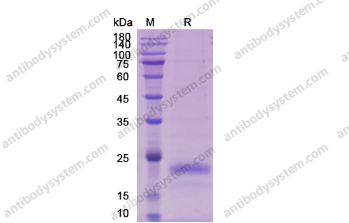 [Antibodysystem] Recombinant Human VEGFA/VEGF165 Protein, C-His