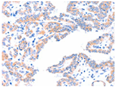 [AFG Scientific] AADACL2 Antibody