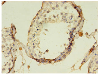 [AFG Scientific] AADAT Antibody