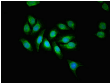 [AFG Scientific] AAGAB Antibody