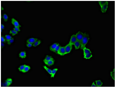 [AFG Scientific] AAK1 Antibody