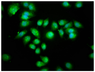 [AFG Scientific] AANAT Antibody