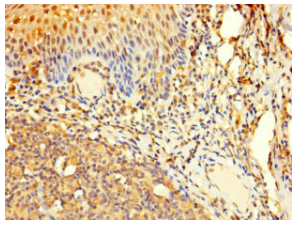 [AFG Scientific] AAR2 Antibody