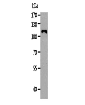 [AFG Scientific] AARS Antibody