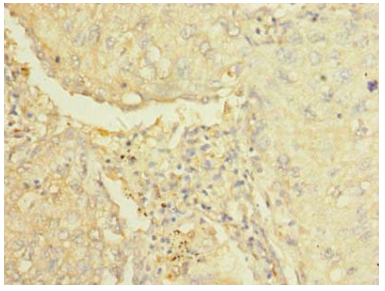 [AFG Scientific] AARSD1 Antibody