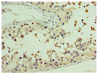 [AFG Scientific] AASDHPPT Antibody