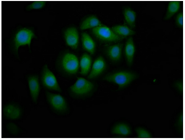 [AFG Scientific] ABCA12 Antibody