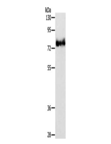 [AFG Scientific] ABLIM1 Antibody