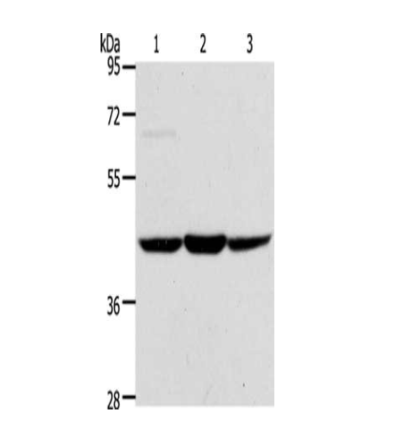 [AFG Scientific] ACADS Antibody