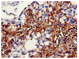 [AFG Scientific] ACADSB Antibody