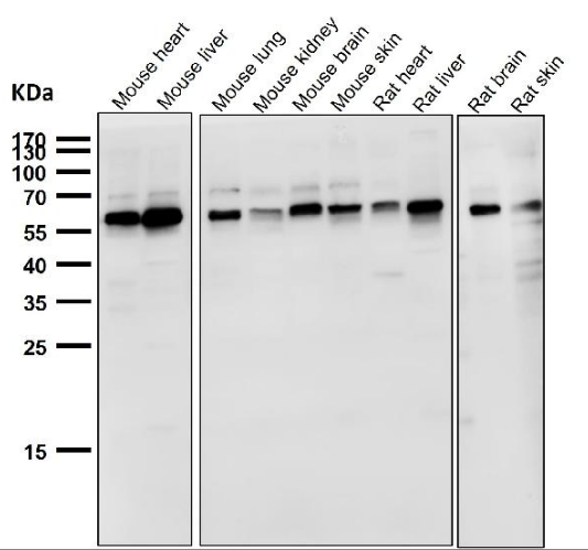 [Boster Bio] Anti-NOX4 Rabbit Monoclonal Antibody