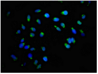 [AFG Scientific] ACBD3 Antibody