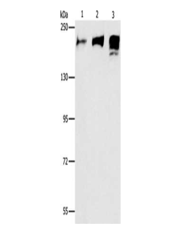 [AFG Scientific] ACE Antibody