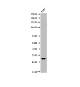 [AFG Scientific] Acetyl-ATF5 (K29) Antibody