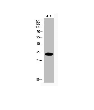 [AFG Scientific] Acetyl-CDKN1C (K278) Antibody