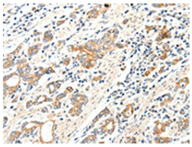 [AFG Scientific] SCN2A Antibody