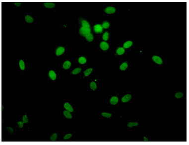 [AFG Scientific] 2-hydroxyisobutyryl-HIST1H1C (K51) Antibody