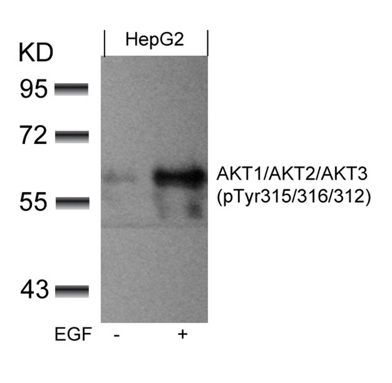 [Signalway Antibody (SAB)] AKT1/AKT2/AKT3(phospho-Tyr315/316/312) Antibody