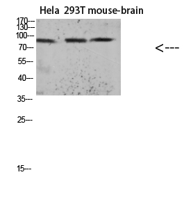 [Signalway Antibody (SAB)] Tau (Acetyl Lys174) Polyclonal Antibody