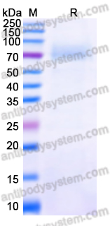 [Antibodysystem] Recombinant Nipah virus G protein/Glycoprotein G Protein, C-His