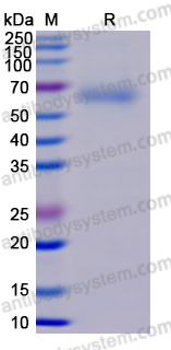 [Antibodysystem] Recombinant Nipah virus/HeV F/Fusion glycoprotein F0 Protein, C-His