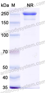 [Antibodysystem] Anti-Human ALPG/ALPPL2 Antibody (12F3)