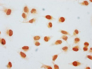 [AFG Scientific] 2-hydroxyisobutyryl-HIST1H1C (K128) Antibody