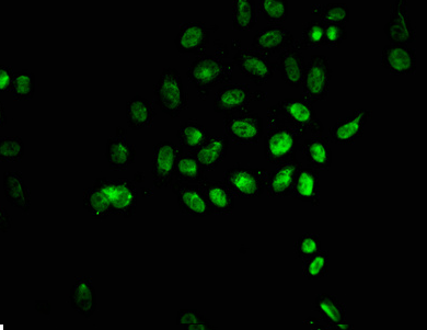 [AFG Scientific] 2-hydroxyisobutyryl-HIST1H1C (K135) Antibody