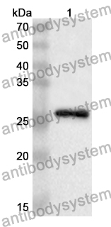 [Antibodysystem] Anti-Adiponectin/ACRP30/ADIPOQ Polyclonal Antibody