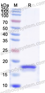 [Antibodysystem] Recombinant Rat TGFB1/TGF-beta-1 Protein, N-His