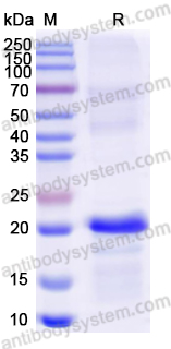 [Antibodysystem] Recombinant Rat IGF2 Protein, N-His