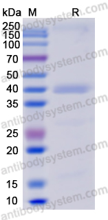 [Antibodysystem] Recombinant SARS-CoV-2 S Protein & E Protein & M Protein, C-His