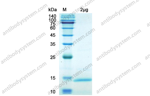 [Antibodysystem] Recombinant SARS-CoV-2 ORF7a/Protein U122 Protein, N-His