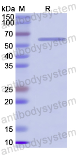 [Antibodysystem] Recombinant SARS-CoV-2 NSP16 Protein, N-GST