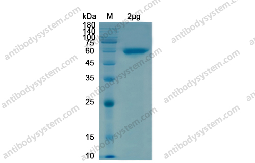 [Antibodysystem] Recombinant SARS-CoV-2 NSP12/RdRp Protein, N-GST