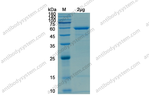 [Antibodysystem] Recombinant SARS-CoV-2 S2/Spike S2 (ECD) Protein, N-His