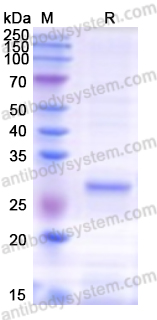 [Antibodysystem] Recombinant Human TSHR Protein, N-His