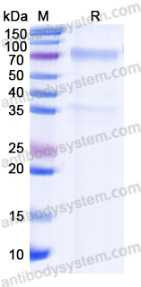 [Antibodysystem] Recombinant Human TSHR/LGR3 Protein, C-Fc