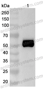 [Antibodysystem] Anti-Human TSHR/LGR3 Antibody (M22)