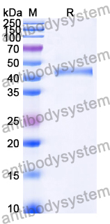 [Antibodysystem] Recombinant Human FGF21 Protein, N-His-SUMO