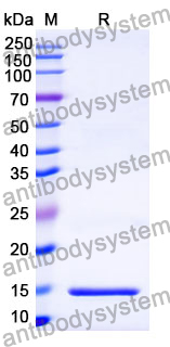 [Antibodysystem] Anti-P.gingivalis PorM Nanobody (Nb01)