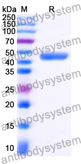 [Antibodysystem] Recombinant Human FGF21 Protein, C-HSA-His